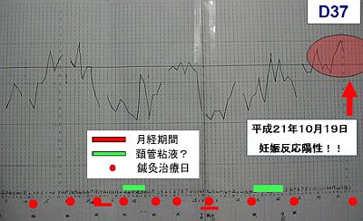 PCOSの妊娠時の基礎体温