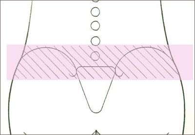 椎間関節性腰痛の発症部位の図